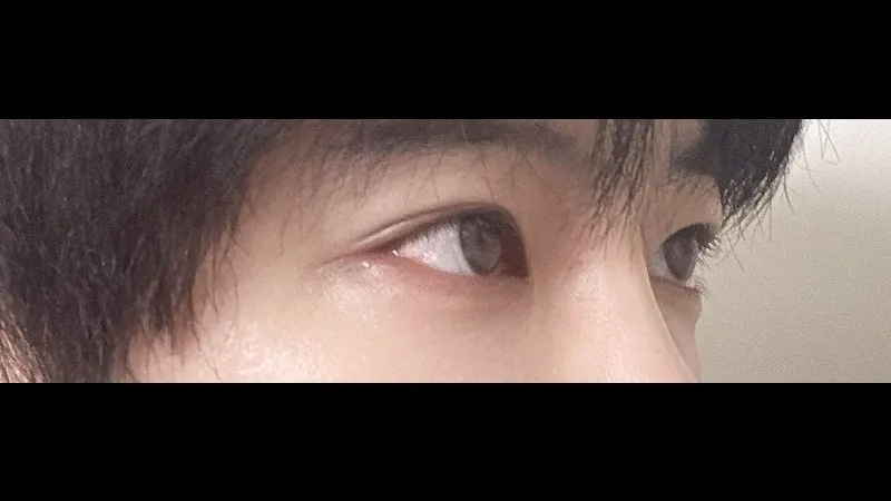 Cases — RE&RE PLASTIC SURGERY 2