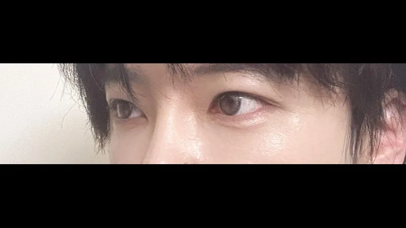 Cases — RE&RE PLASTIC SURGERY 4