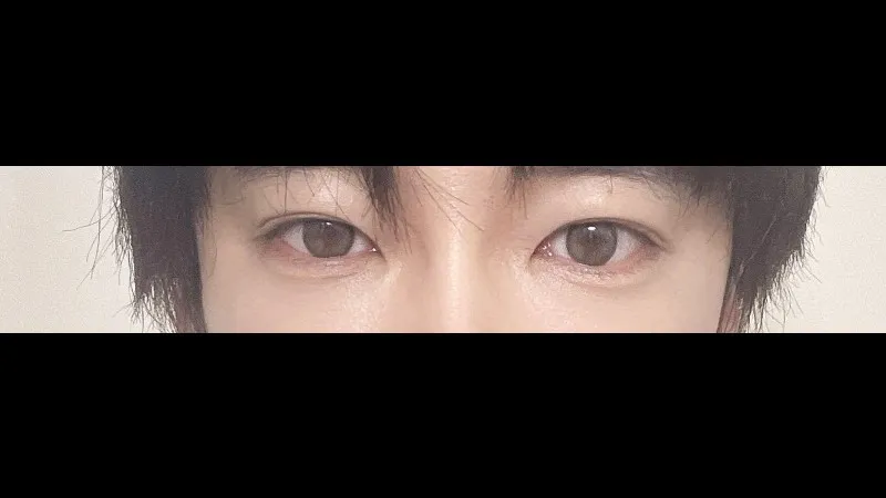 Cases — RE&RE PLASTIC SURGERY 5