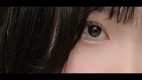 Natural Adhesion Double Eyelid Surgery, Ptosis Correction — RE&RE PLASTIC SURGERY 3