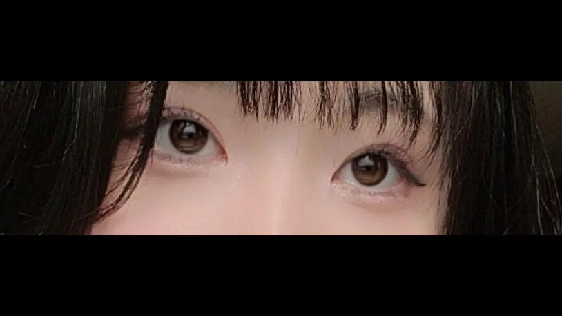 Natural Adhesion Double Eyelid Surgery, Ptosis Correction — RE&RE PLASTIC SURGERY 5