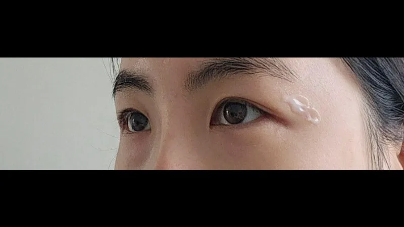 Incisional Double Eyelid Surgery — RE&RE PLASTIC SURGERY 3