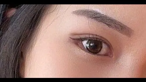 Partial Incision Double Eyelid Surgery — RE&RE PLASTIC SURGERY 3