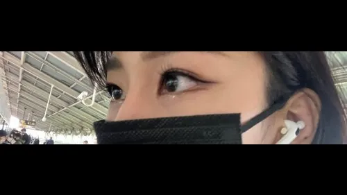 目の下脂肪再配置, 目の下脂肪移植 — RE&RE PLASTIC SURGERY 6