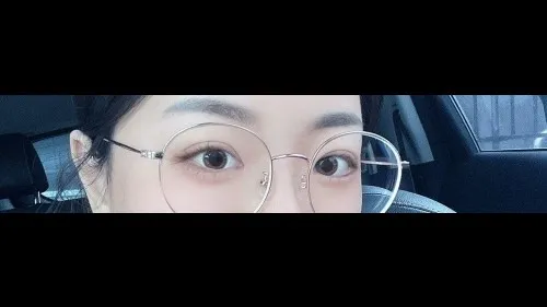 Incisional Double Eyelid Surgery — RE&RE PLASTIC SURGERY 3