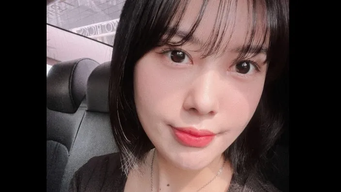 Incisional Double Eyelid Surgery, Ptosis Correction, Lower Eyelid Fat Repositioning, Lower Eyelid Fat Grafting, Facial Fat Grafting — RE&RE PLASTIC SURGERY 3