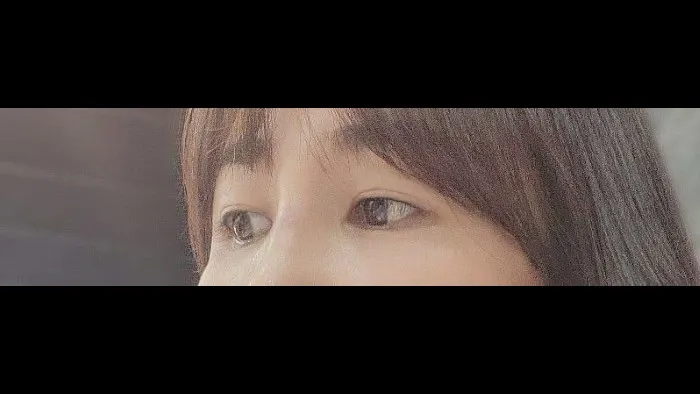 Sub-brow Lift, Lower Eyelid Fat Grafting — RE&RE PLASTIC SURGERY 4