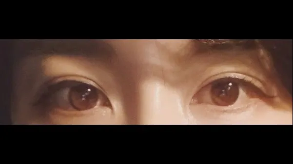 Incisional Double Eyelid Surgery, Lower Eyelid Fat Grafting — RE&RE PLASTIC SURGERY 3