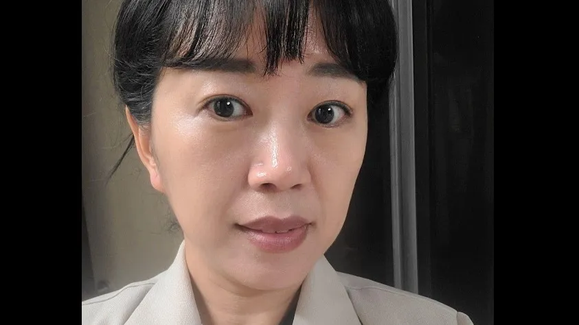 Sub-brow Lift, Facial Fat Grafting — RE&RE PLASTIC SURGERY 4