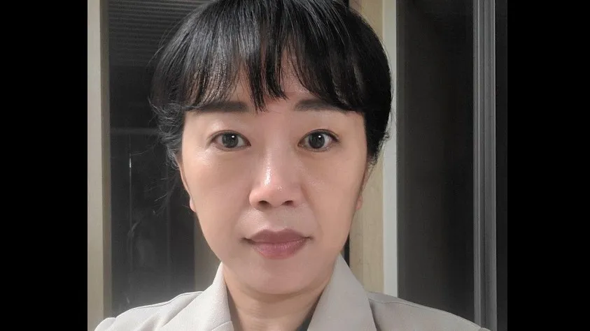 Sub-brow Lift, Facial Fat Grafting — RE&RE PLASTIC SURGERY 5