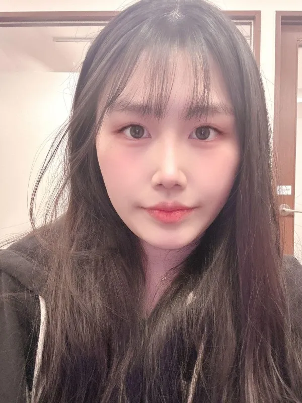 Partial Incision Double Eyelid Surgery, Ptosis Correction, Lower Eyelid Fat Grafting, Nasal Bridge, Nasal Tip — RE&RE PLASTIC SURGERY 5