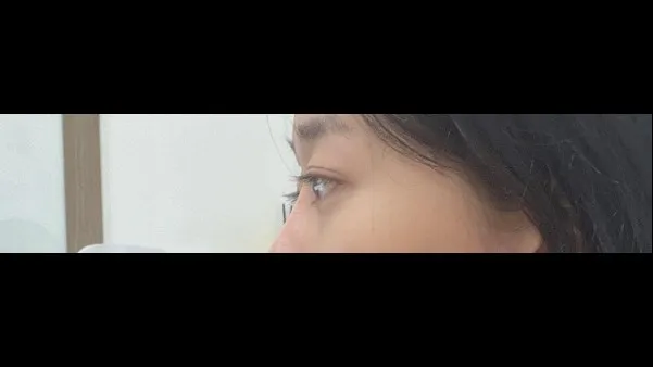 Natural Adhesion Double Eyelid Surgery, Ptosis Correction, Facial Fat Grafting — RE&RE PLASTIC SURGERY 6