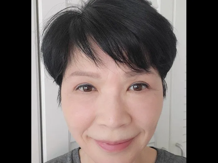 Sub-brow Lift, Lower Blepharoplasty (Aging Eye Rejuvenation) — RE&RE PLASTIC SURGERY 6