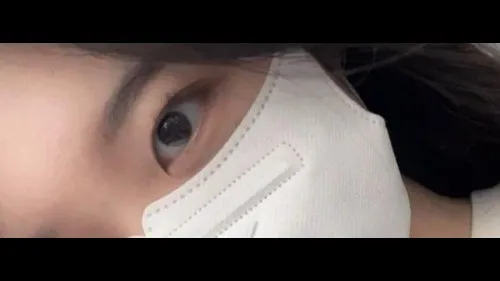 Natural Adhesion Double Eyelid Surgery, Ptosis Correction — RE&RE PLASTIC SURGERY 3