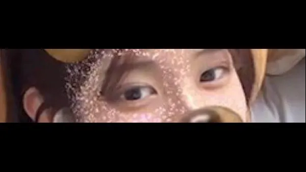 Incisional Double Eyelid Surgery — RE&RE PLASTIC SURGERY 4