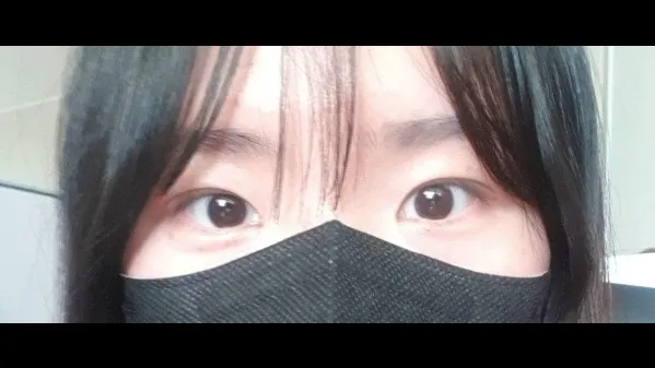 自然粘连法 — RE&RE PLASTIC SURGERY 2