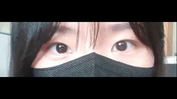 自然粘连法 — RE&RE PLASTIC SURGERY 5