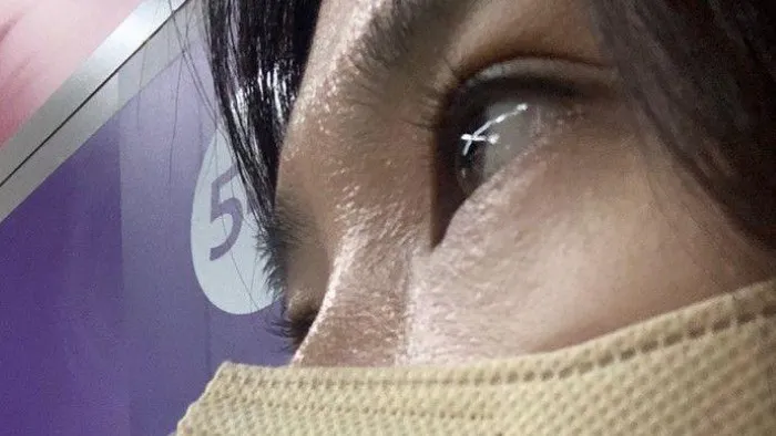 眉下リフト, 下眼瞼形成(中高年の目元) — RE&RE PLASTIC SURGERY 3