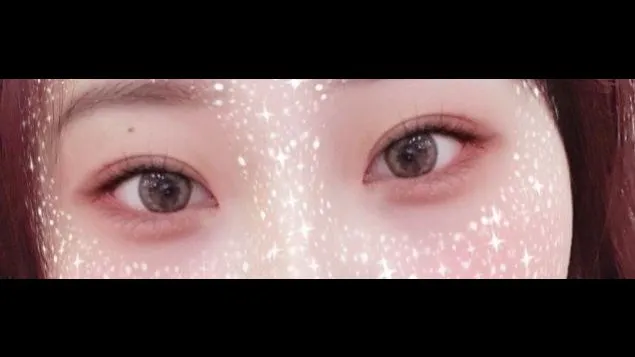 Partial Incision Double Eyelid Surgery, Ptosis Correction — RE&RE PLASTIC SURGERY 3