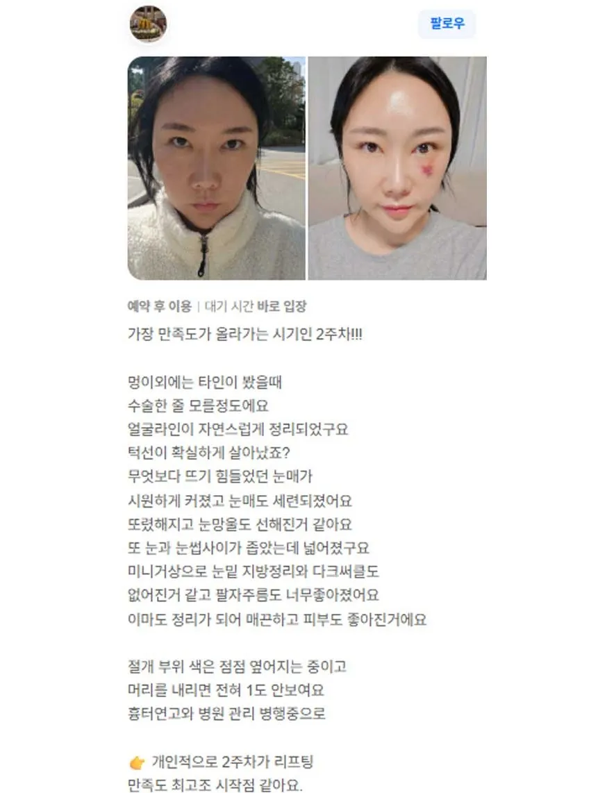 Cases — Rewind Plastic Surgery 1