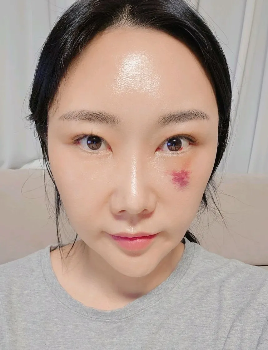 Cases — Rewind Plastic Surgery 3