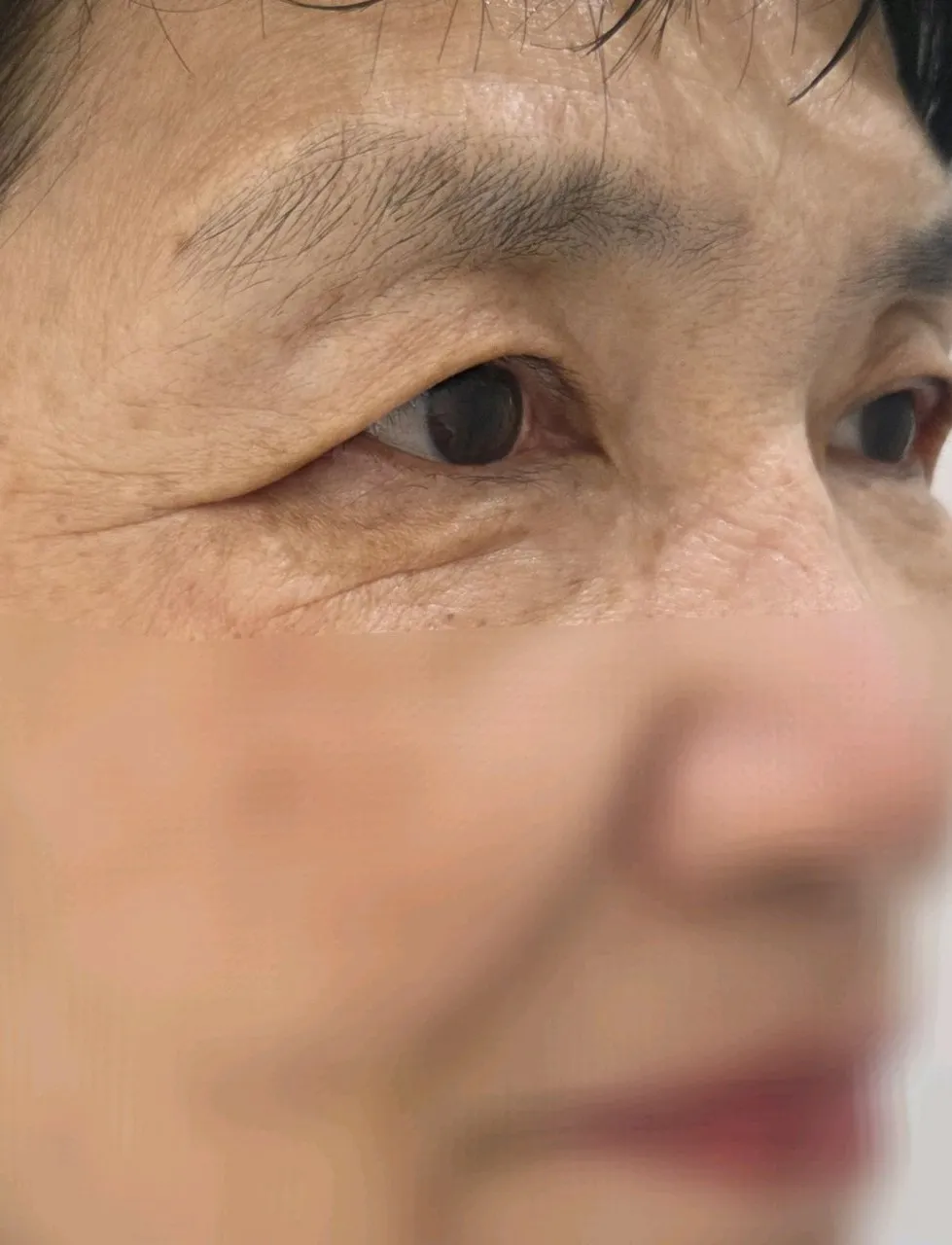 Cases — Rewind Plastic Surgery 2