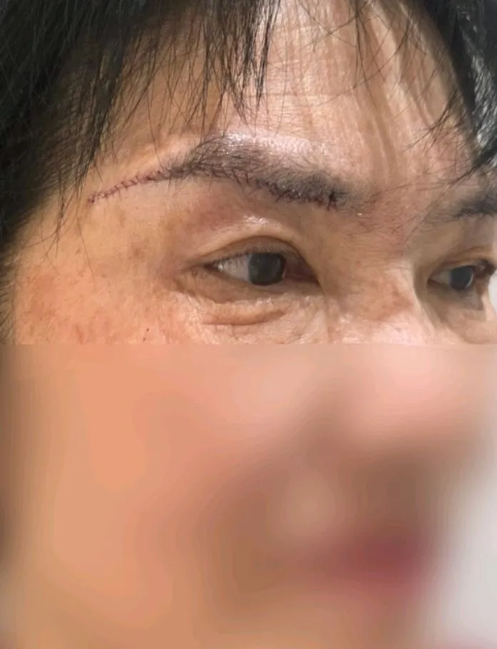 Cases — Rewind Plastic Surgery 3