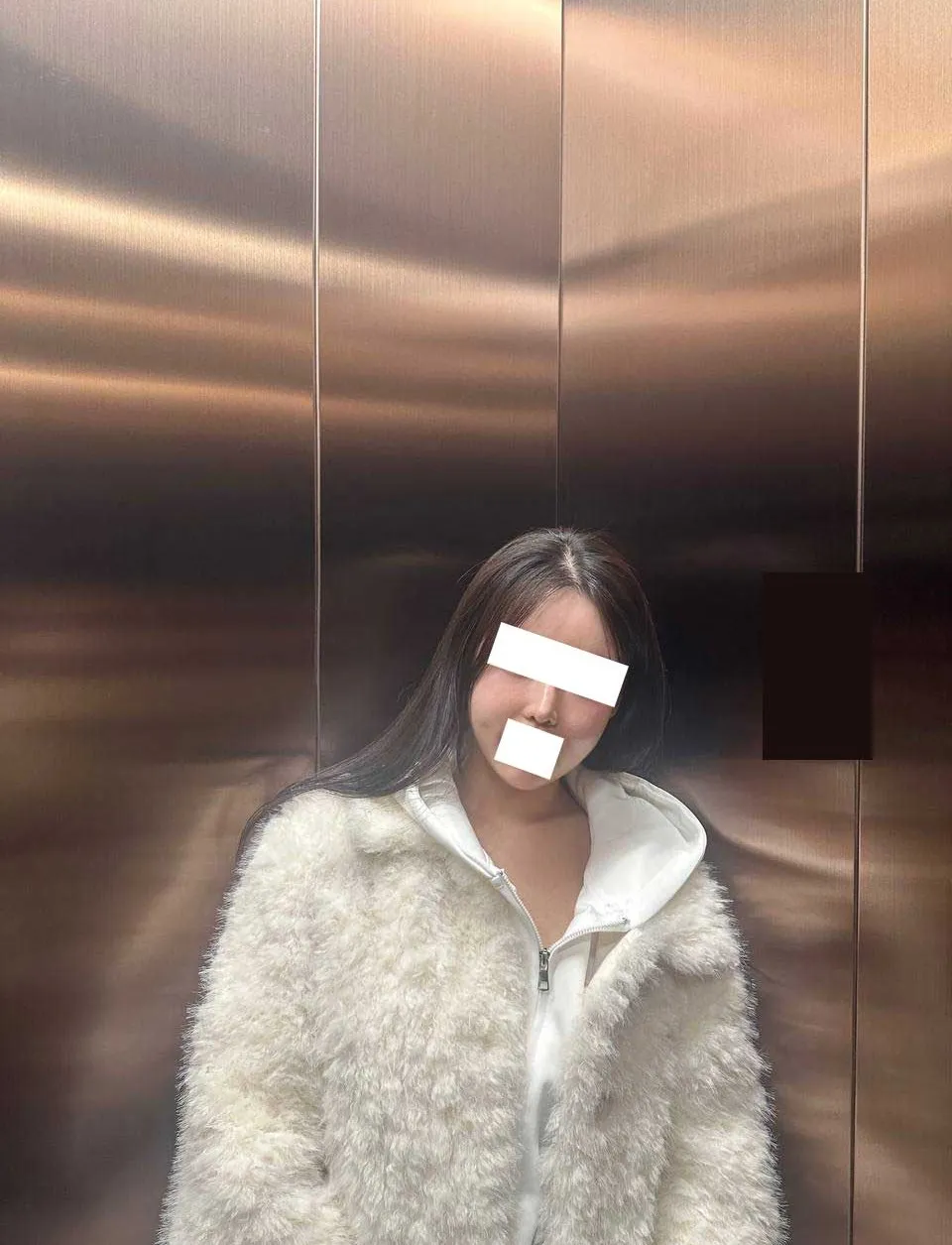 Chin Liposuction — Rewind Plastic Surgery 7