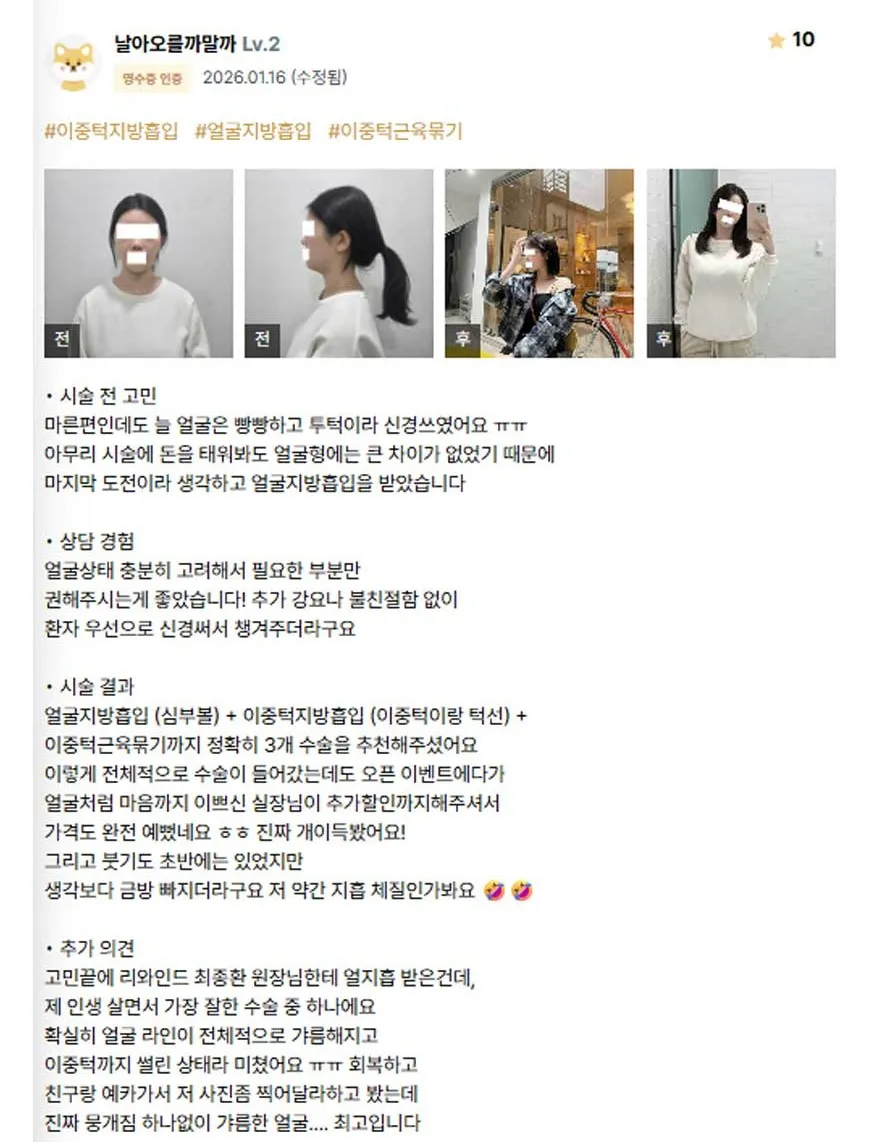 Chin Liposuction 1