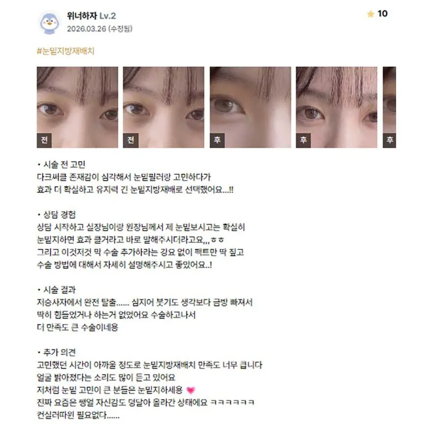 Lower Eyelid Fat Repositioning 1