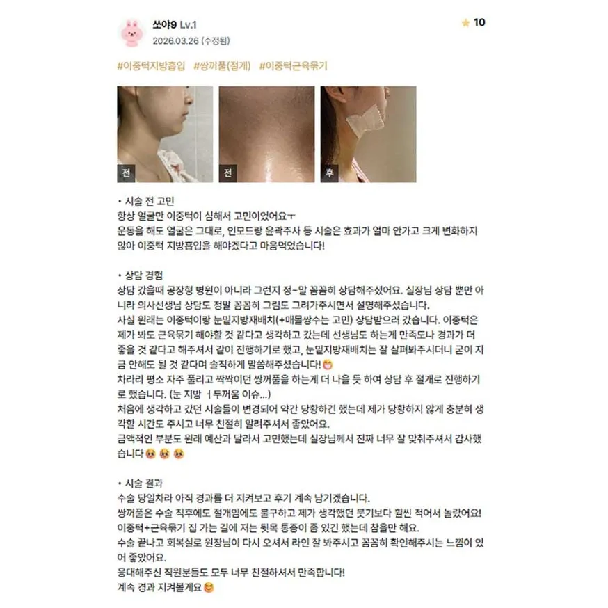 Chin Liposuction 1