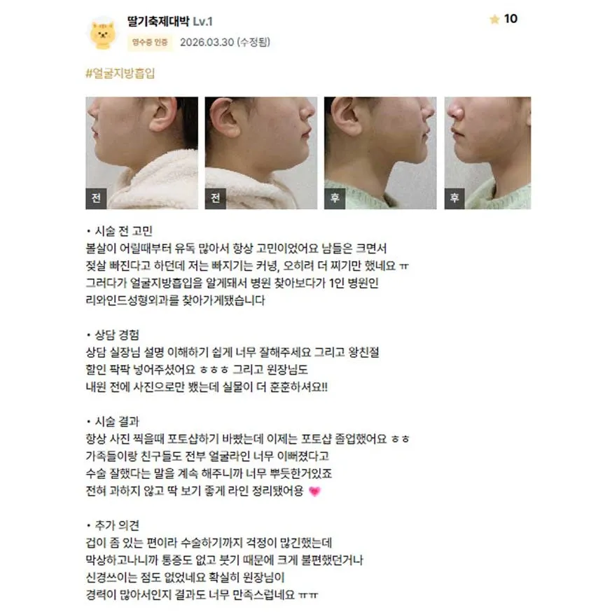 Chin Liposuction — Rewind Plastic Surgery 1