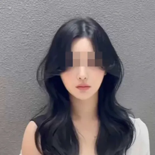 Chin Liposuction — Rewind Plastic Surgery 4