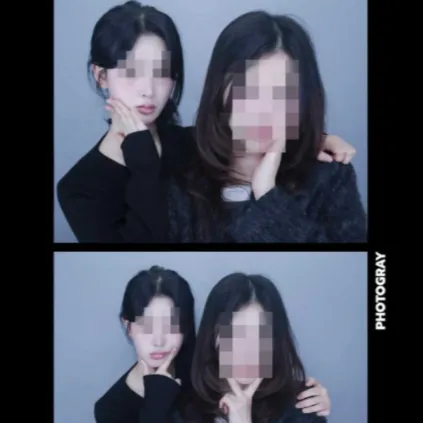 Chin Liposuction — Rewind Plastic Surgery 6