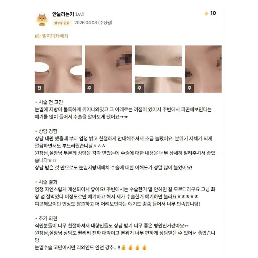 Lower Eyelid Fat Repositioning 1