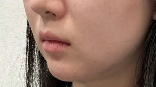 Cases — HYUNDAI AESTHETIC PLASTIC SURGERY 3