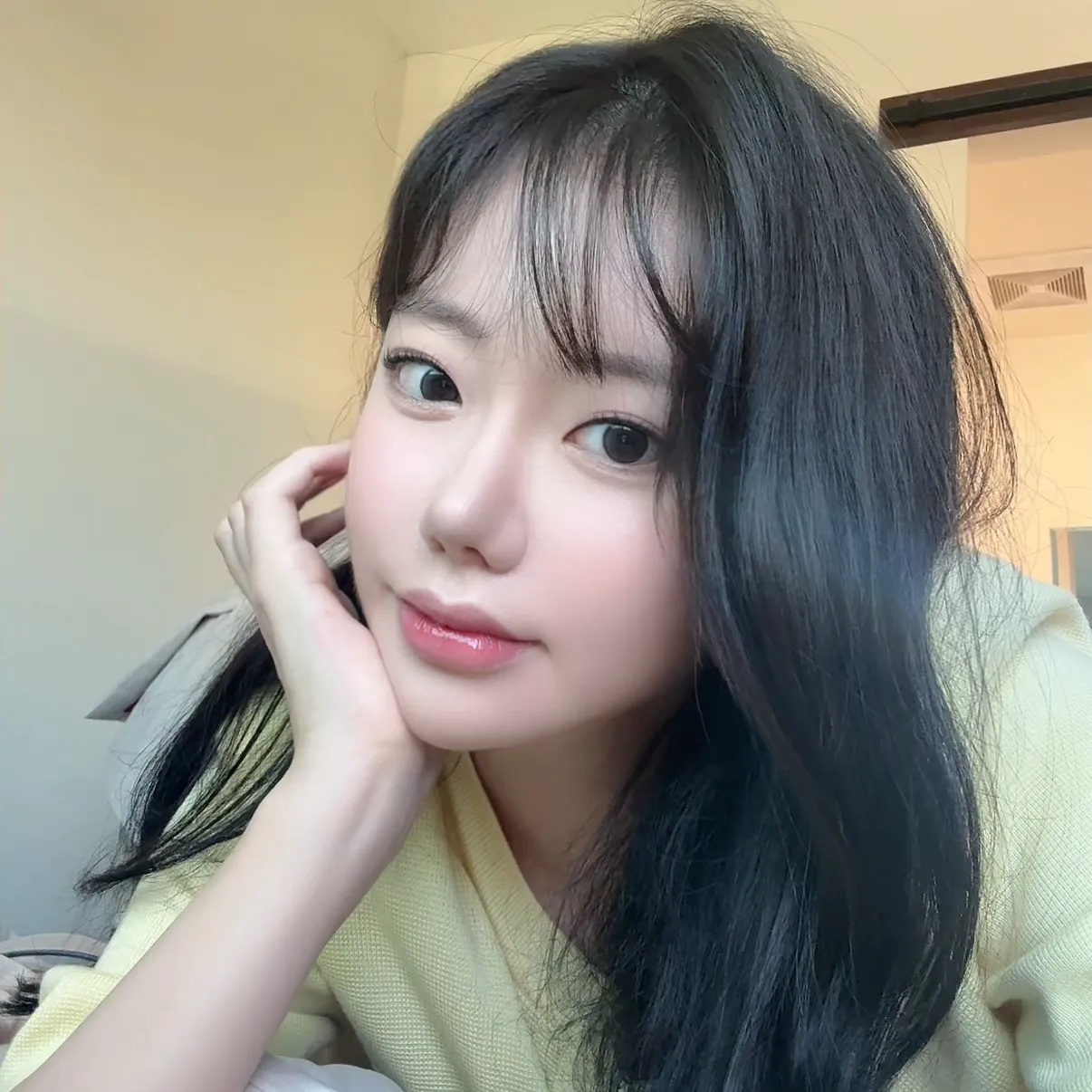 Rhinoplasty Revision — Luho Plastic Surgery 5