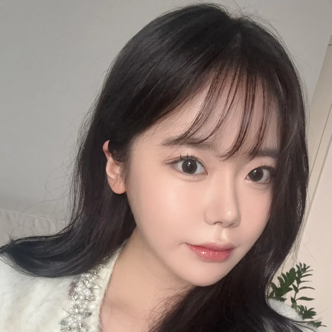 Rhinoplasty Revision — Luho Plastic Surgery 6
