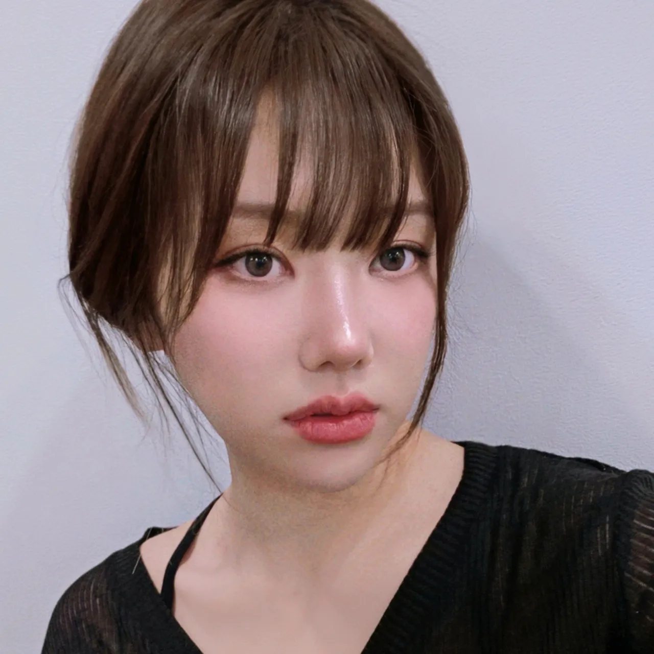 Natural Adhesion Double Eyelid Surgery, Epicanthoplasty, Hump Nose — Luho Plastic Surgery 4