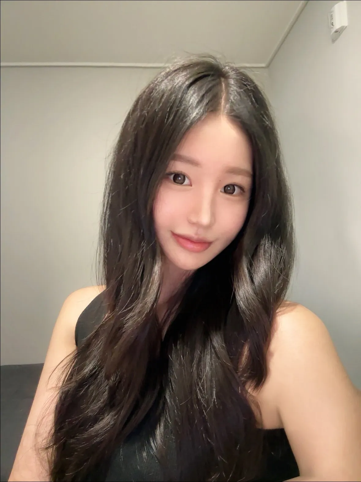 Revision surgery, Hump Nose, Crooked Nose — Luho Plastic Surgery 4