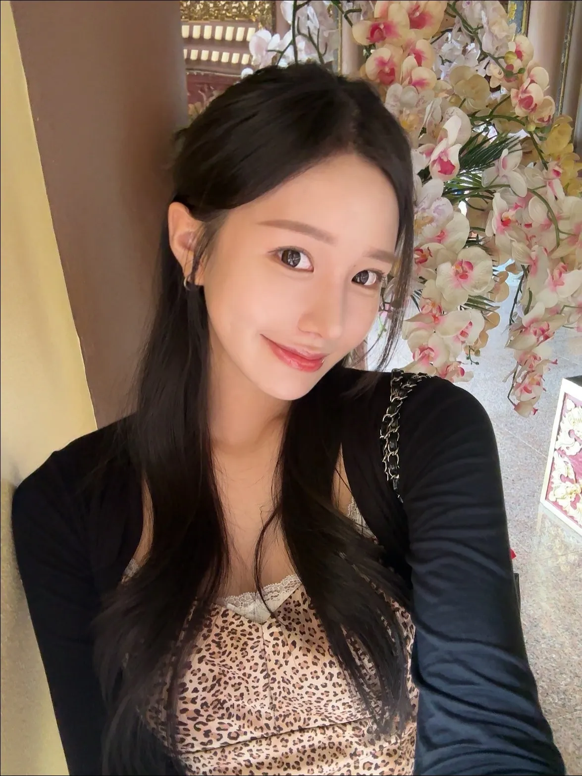 Revision surgery, Hump Nose, Crooked Nose — Luho Plastic Surgery 5