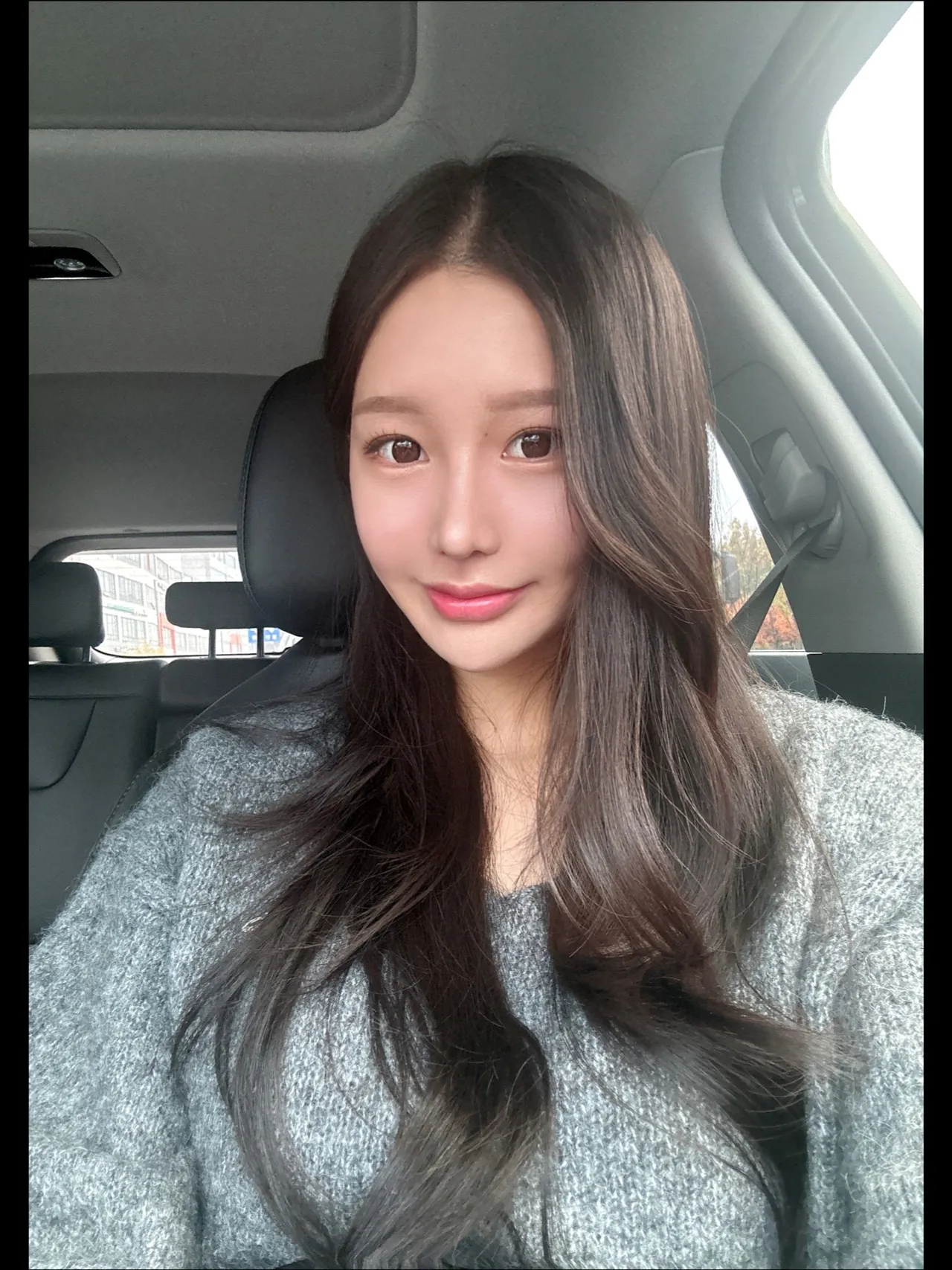 Revision surgery, Hump Nose, Crooked Nose — Luho Plastic Surgery 6