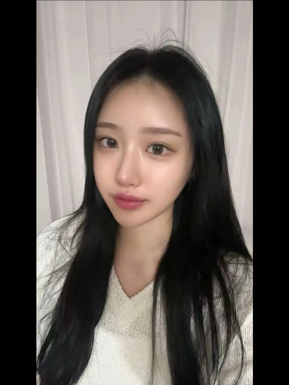 Natural Adhesion Double Eyelid Surgery, Ptosis Correction, Hump Nose — Luho Plastic Surgery 5