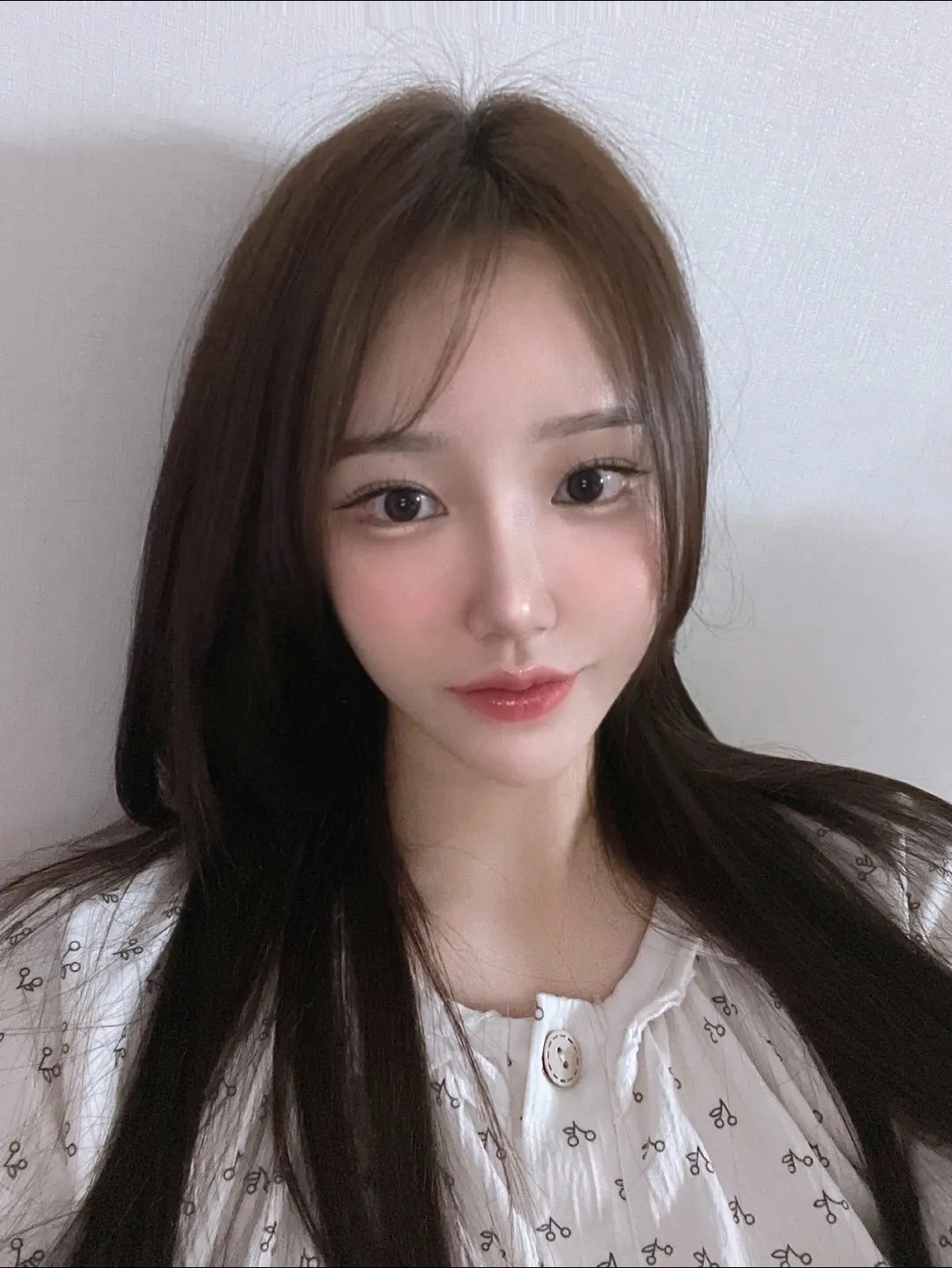 Natural Adhesion Double Eyelid Surgery, Ptosis Correction, Hump Nose — Luho Plastic Surgery 6