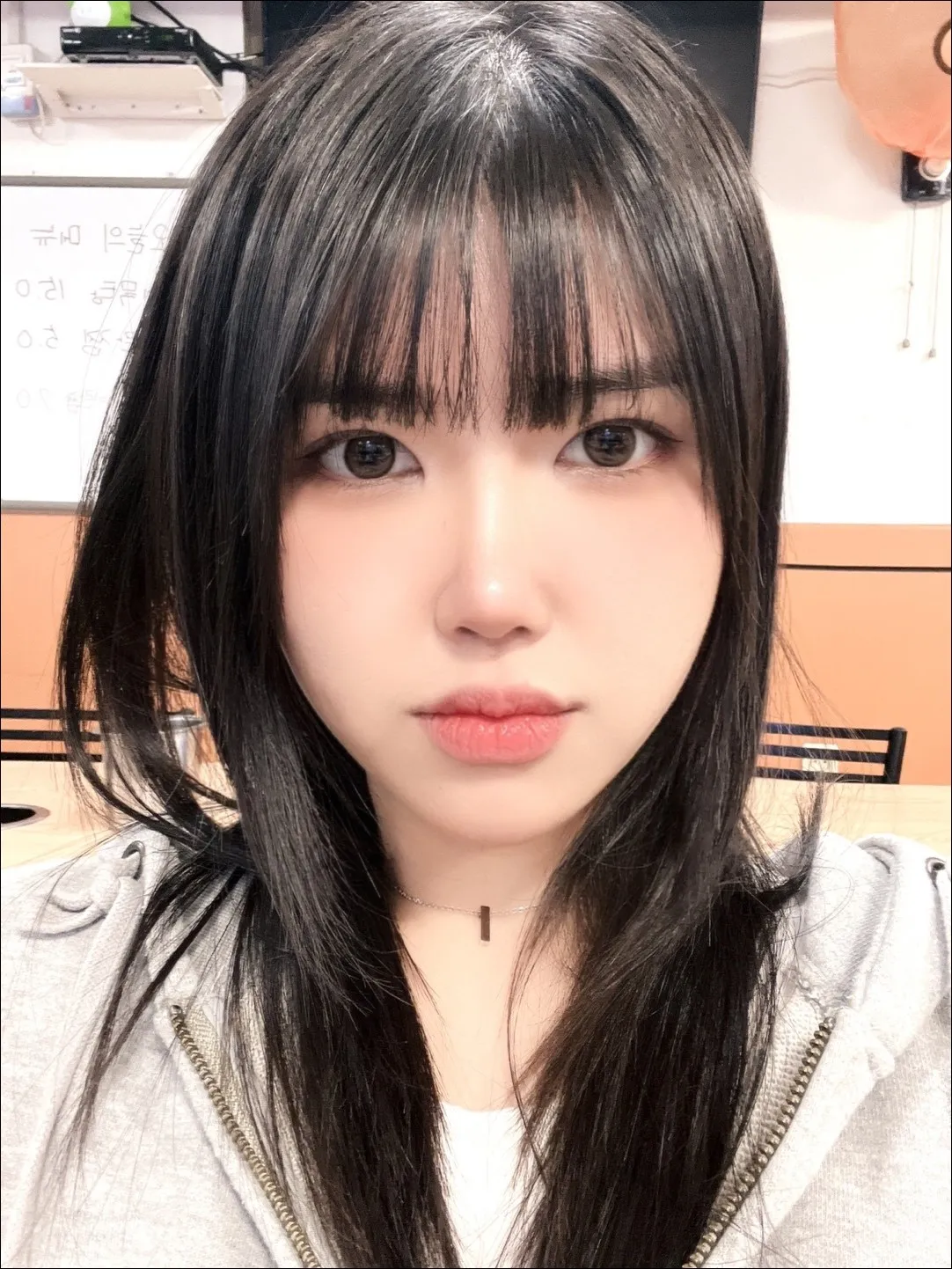 Epicanthoplasty, Natural Adhesion Double Eyelid Surgery, Low Bridge Nose — Luho Plastic Surgery 4