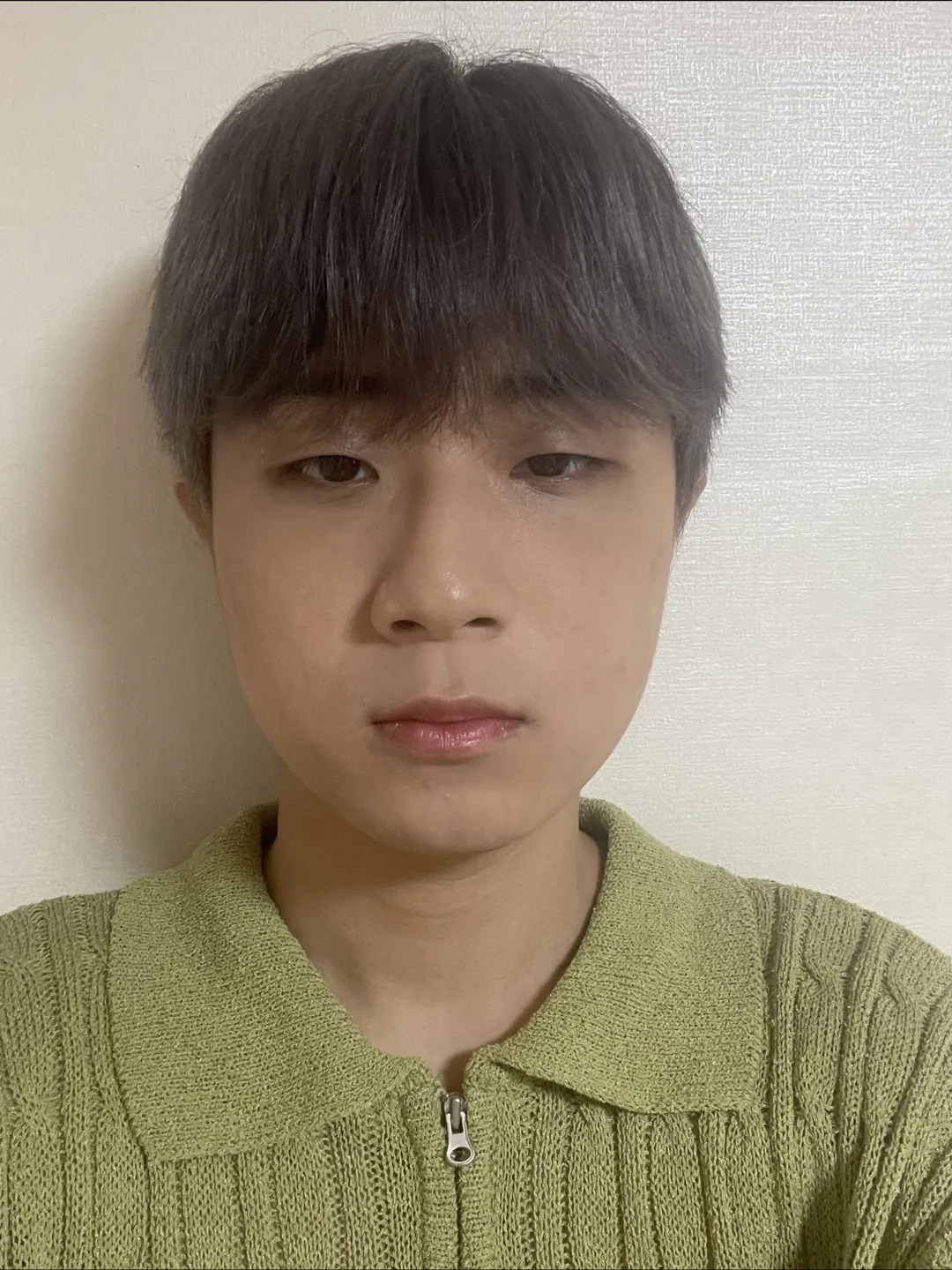 Incisional Double Eyelid Surgery, Ptosis Correction, Epicanthoplasty, Hump Nose, Crooked Nose 1