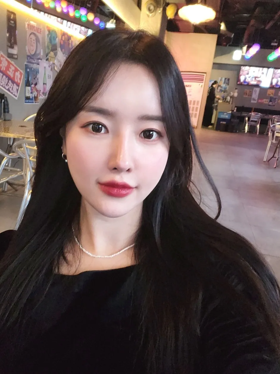 Lower Eyelid Fat Repositioning, Full-Face Thread lift — Luho Plastic Surgery 4