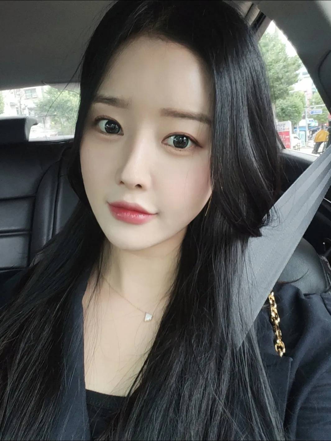Lower Eyelid Fat Repositioning, Full-Face Thread lift — Luho Plastic Surgery 5