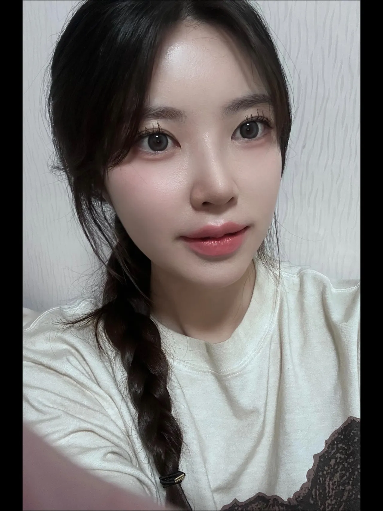 Chin Liposuction, Hump Nose, Low Bridge Nose — Luho Plastic Surgery 4