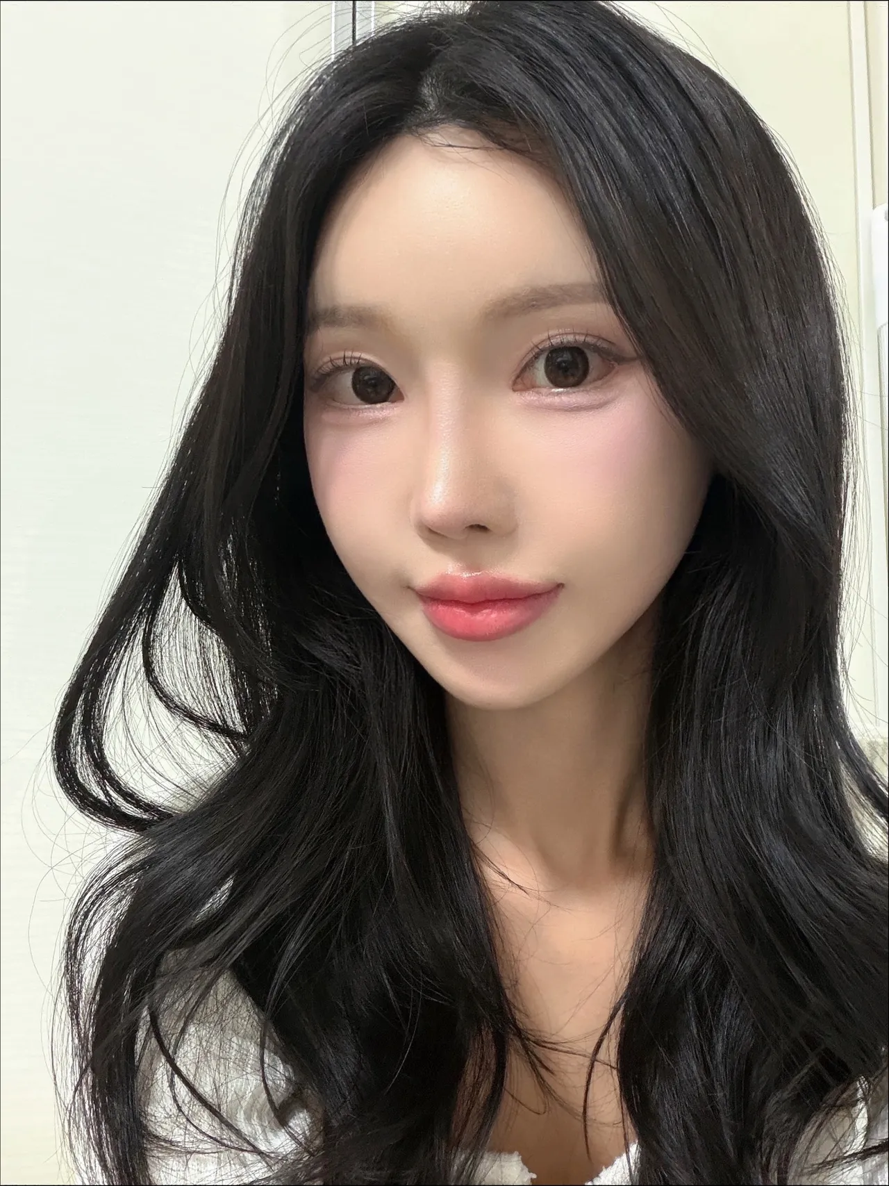 Rhinoplasty Revision — Luho Plastic Surgery 5